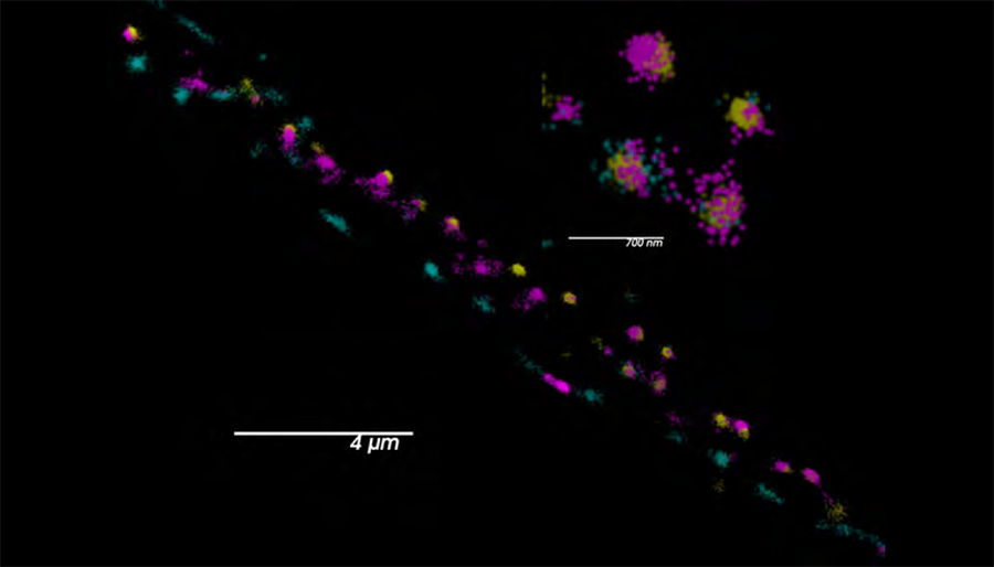 Synaptic markers illuminate the worm’s nervous system with color-coded highlights.
