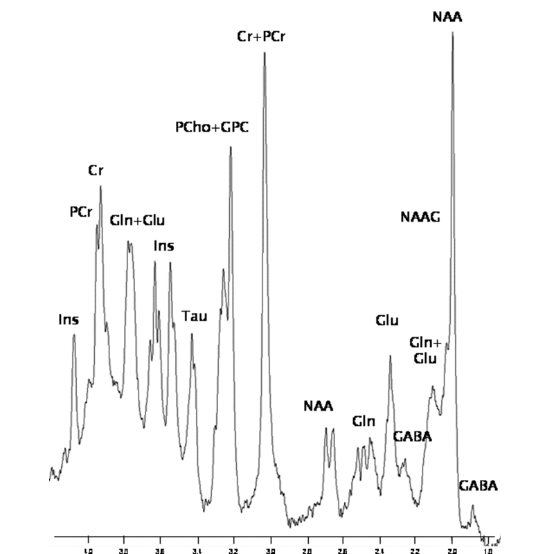 Excellent spectral resolution in vivo spectrum at 9.4T