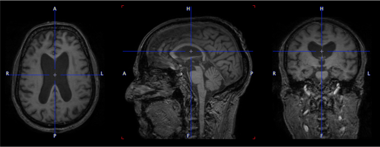 Ai-based segmentation