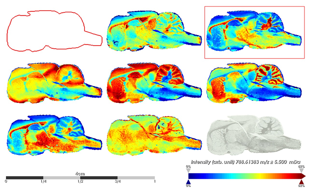 Lipid Images in rat brain