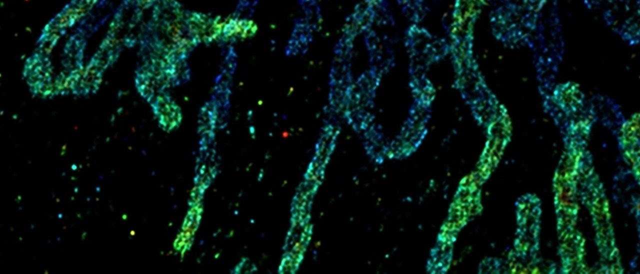 Advances in Dye Development and Microscopy for Live Cell Super