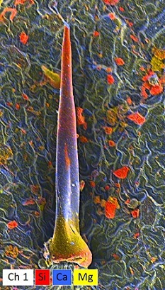 荨麻毛状体超分辨率图像