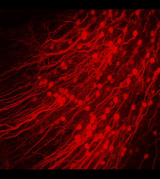 3D-view of volumetric stack recorded using the ETL focusing module. Layer 5B neurons in mouse visual cortex in vivo, labelled with tdTomato
