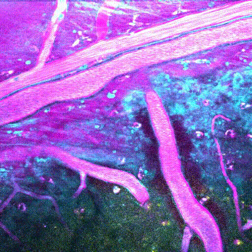 Blood vessels are shown in magenta and neuronal cell bodies labeled with a calcium dye are shown in yellow. Fibers and processes including the white matter are shown in cyan.