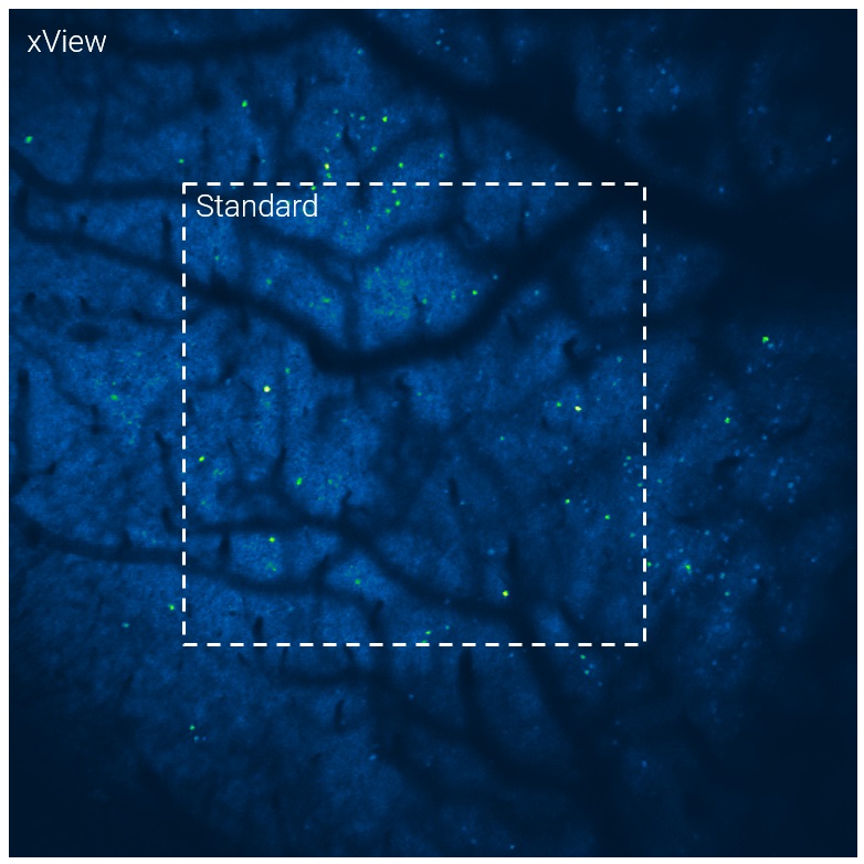 Image of brain tissue imaged with Bruker's Ultima 2pPlus multiphoton microscope with the xView module, with the standard vs. extended FOV labeled