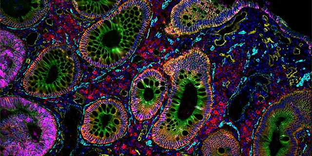 CellScape Microfluidic Chips