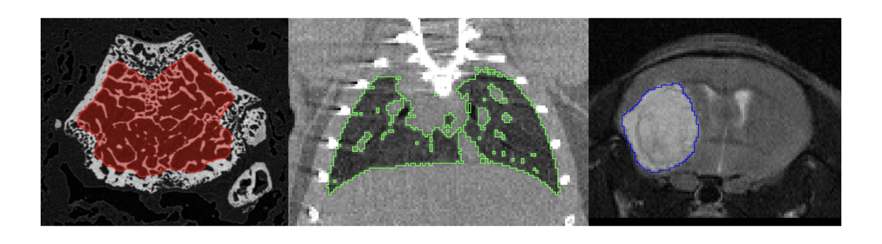 CT/MR Segmentation