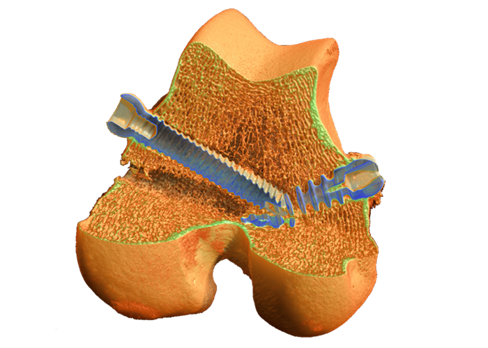 生命科学领域的显微CT成像